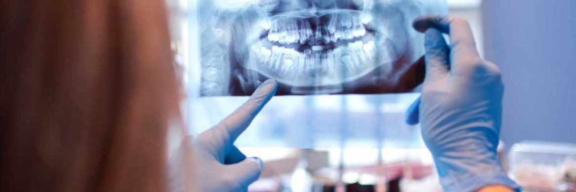 A forensic dentist examines dental x-rays.